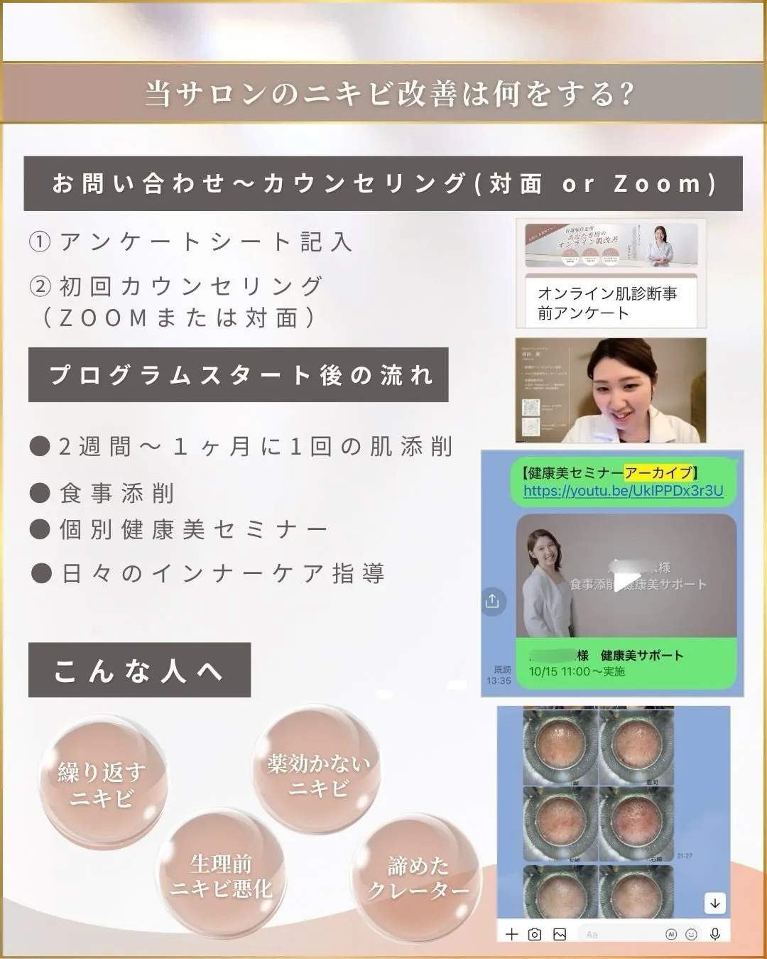 ここまで頑張ってるのに、治らない。
